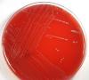 Бактерия enterococcus faecalis в мазке у мужчин